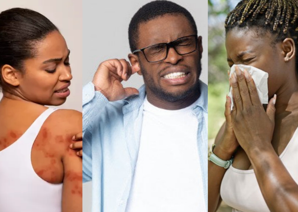 Allergy Testing: Identify and Manage Allergies